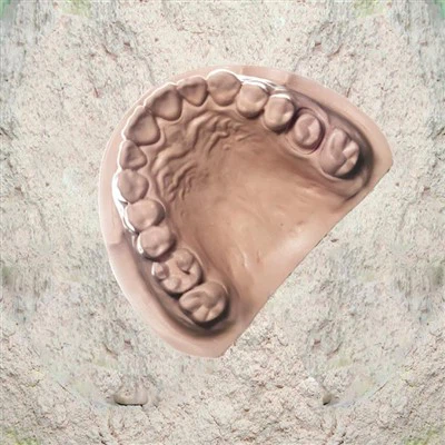 Gypse dentaire Type IV - Die Stone